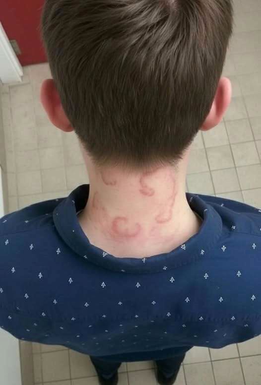®“My 8-Year-Old Has Been Dealing With This for 2 Months—It’s Only Getting Worse 😟 What Could It Be?” (Check In First comment👇)