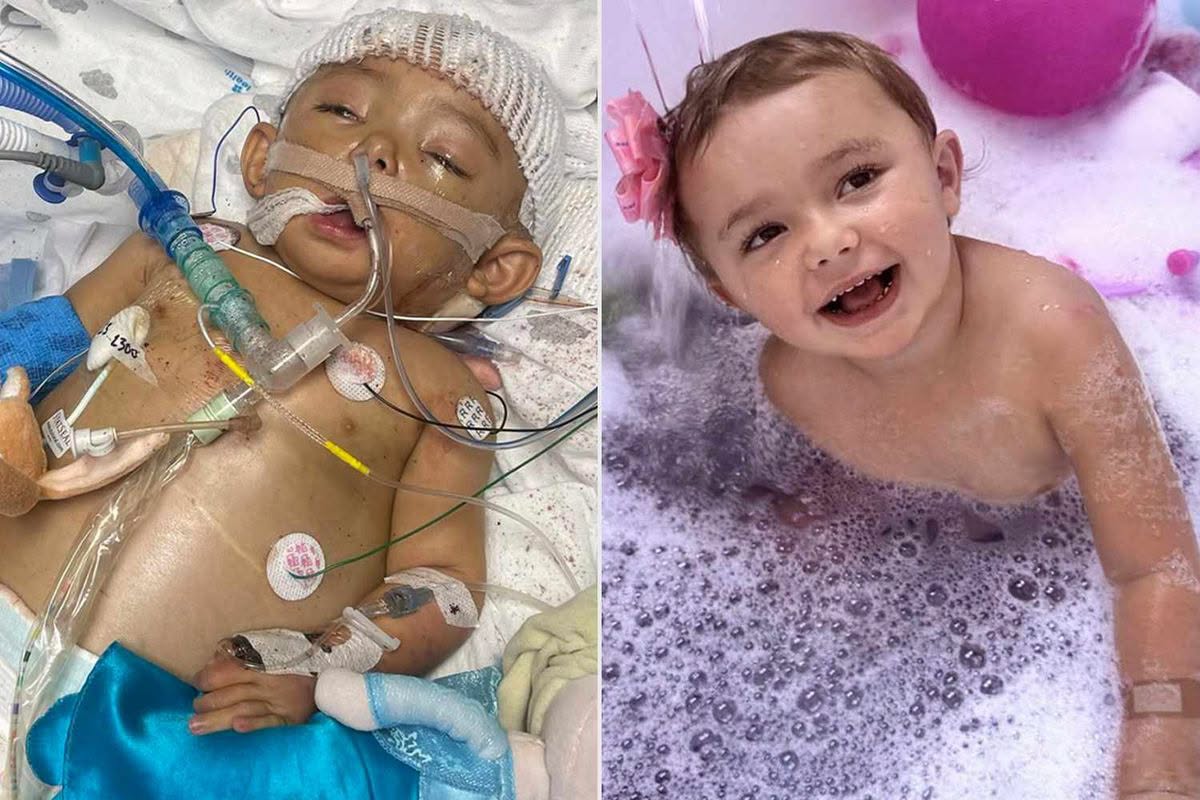 Girl Survived 25 Surgeries, a Liver Transplant and the Loss of 5 Fingers All Before Turning the Age of 3… See more