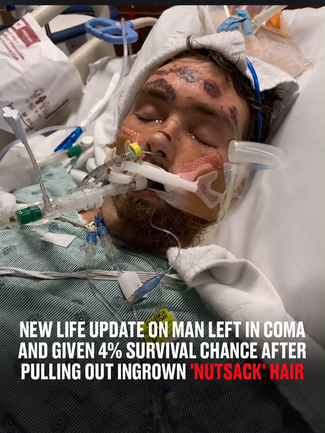 Doctors warned the family that he could be ‘brain dead’
