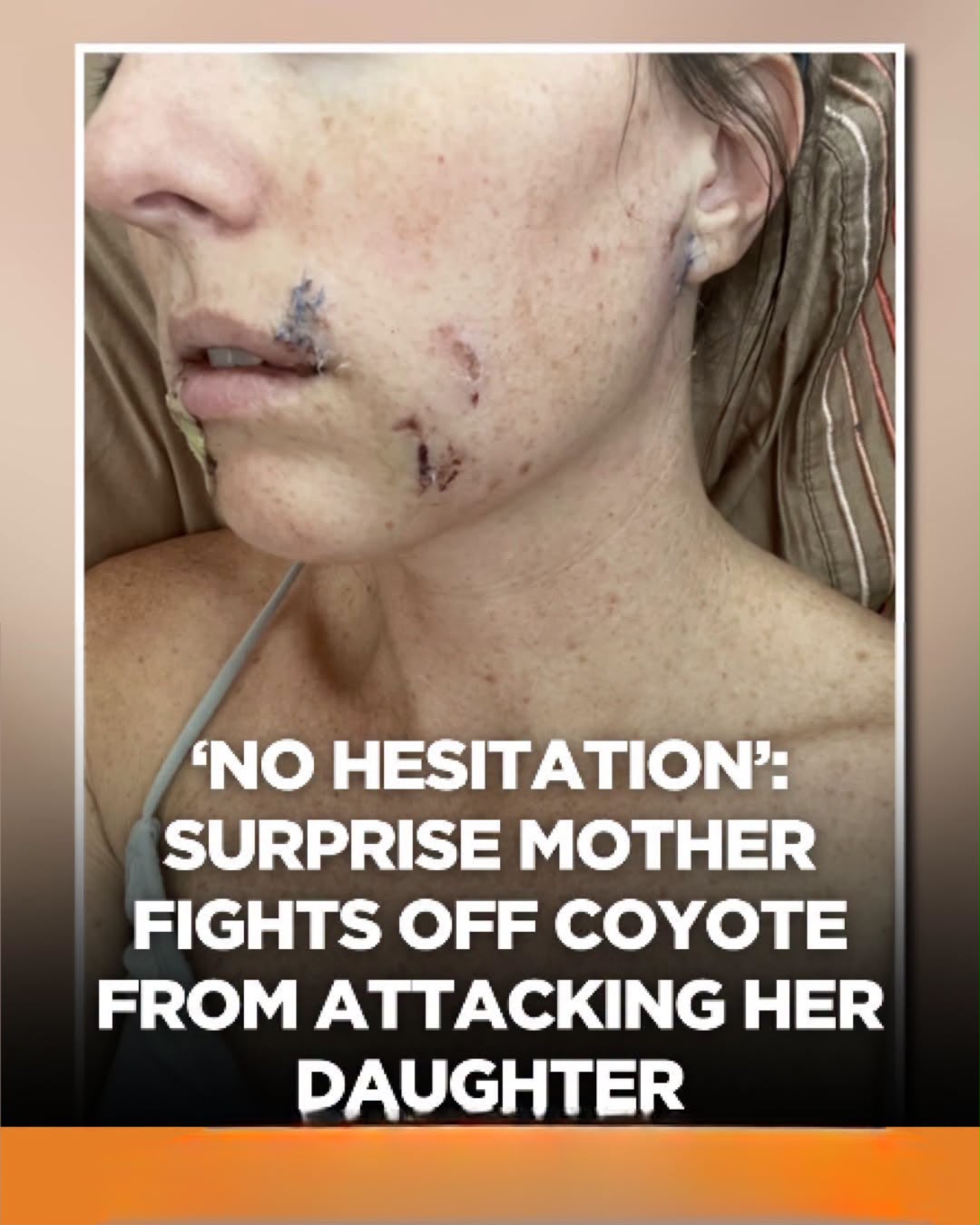 A Surprise mother is recovering after fighting off a coyote that attacked her 4-year-old daughter.